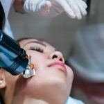 Rf Microneedling: The Latest Non-Cosmetic Treatment for Skin Rejuvenation in Singapore